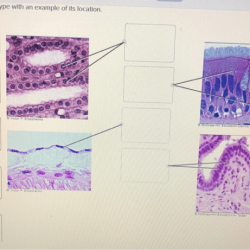 Match each tissue type with an example of its location