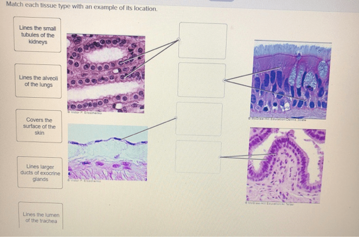 Match each tissue type with an example of its location