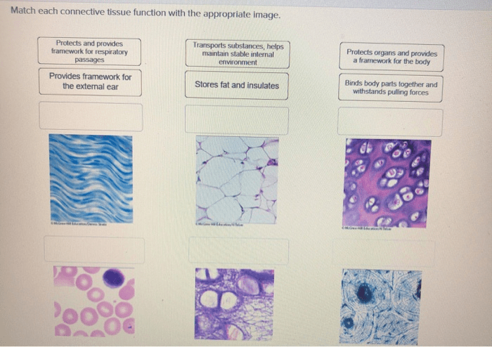 Match each tissue type with an example of its location